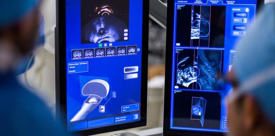 Are Prostate Cancer Deaths On The Rise?